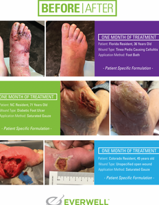 Everwell - 1 Month - Before and After