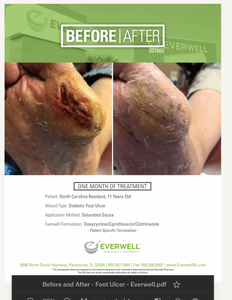 Everwell - Foot Ulcer - Before and After