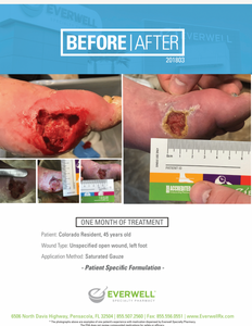 Everwell - Open Wound - Before and After