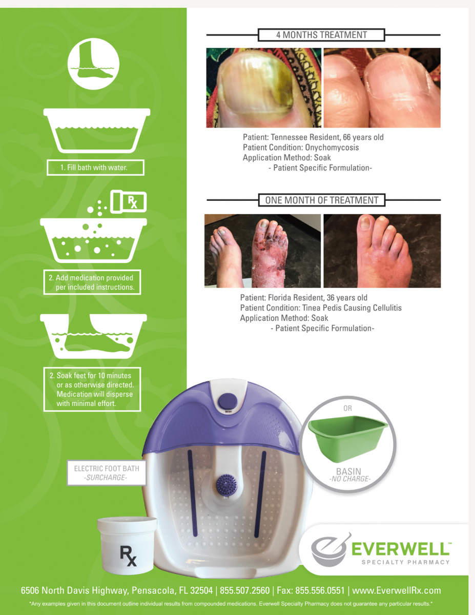 Everwell Foot Soak After Treatment Revelation Marketing